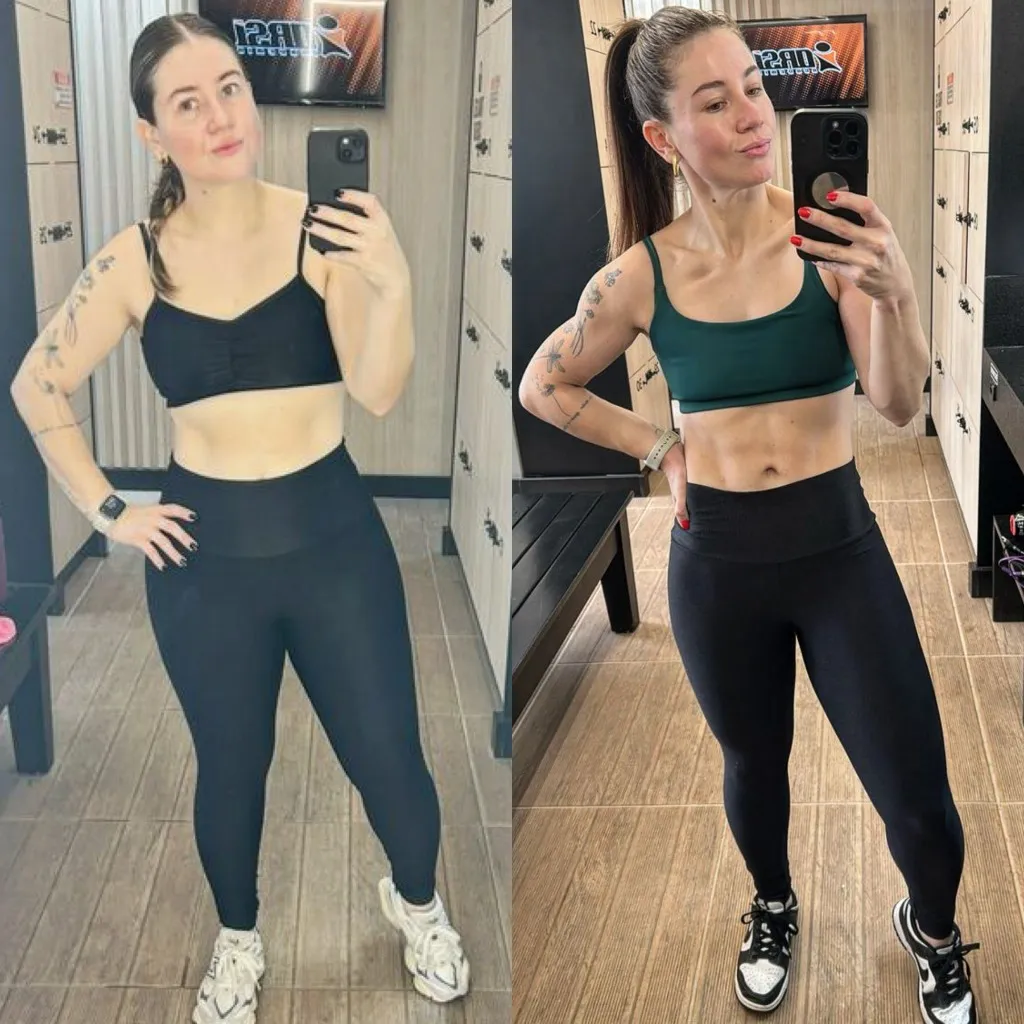 Antes e Depois de Fernanda